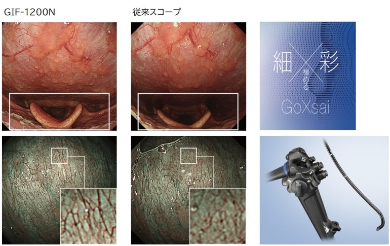 胃カメラ検査機器